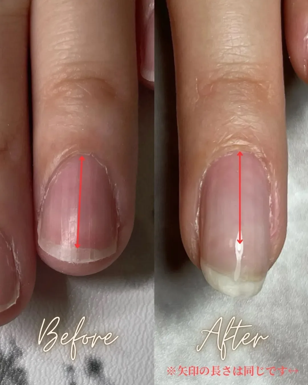 40代Y様の施術事例（育成期間6ヶ月）