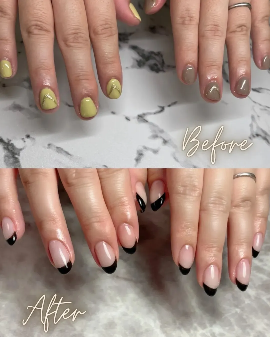 40代Y様の施術事例（育成期間8ヶ月）